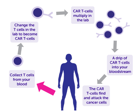Diagram of how chimeric antigen receptor – T cell (CAR-T) works